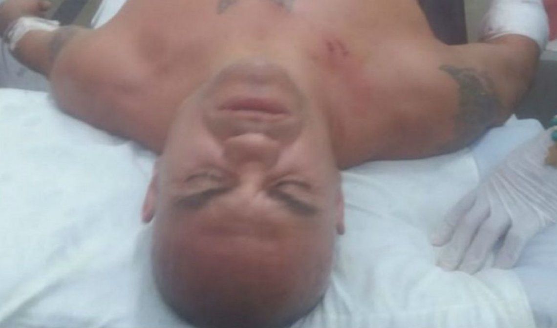 La Hiena Barrios fue dado de alta y creen que quisieron matarlo