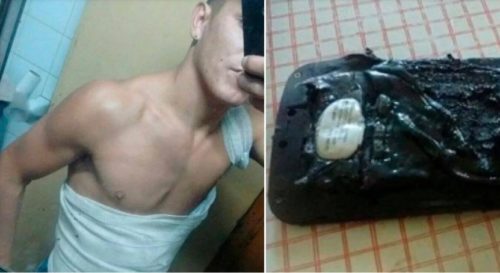 A un joven en Córdoba le explotó el celular mientras dormía: «Me desperté en llamas»