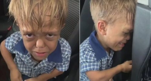 Australia: Un niño con enanismo quebró en llanto y sufrió una crisis tras reiteradas escenas de bullying; «Me quiero morir»