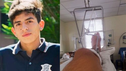 Entre Ríos: Fue a una fiesta de 15 y le rompieron el fémur tras una feroz golpiza