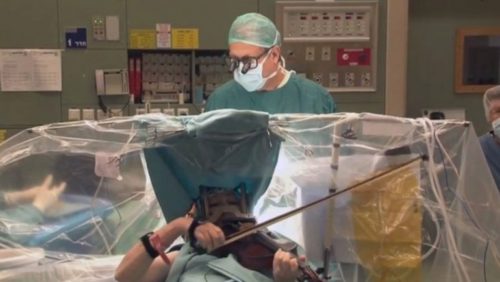 Inglaterra: tocó el violín mientras le extirpaban un tumor cerebral