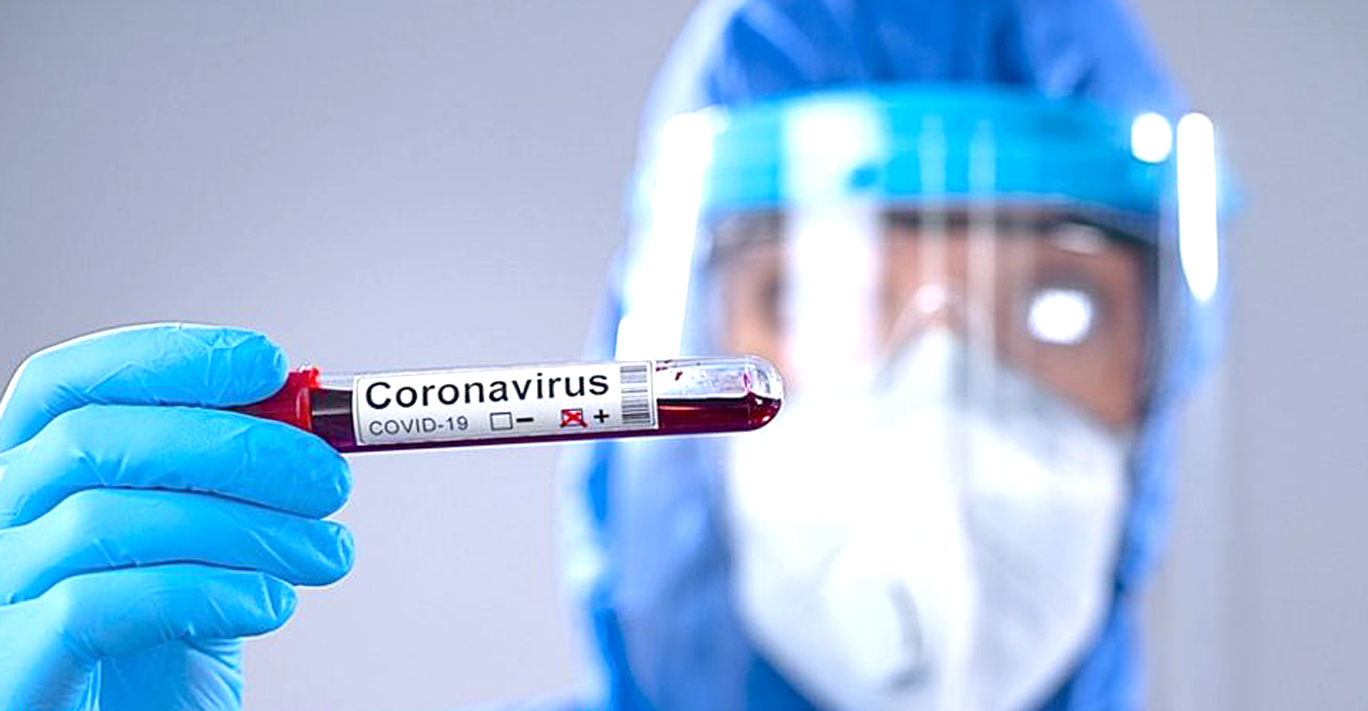 Se registraron 32 nuevos casos de coronavirus en la provincia de Mendoza