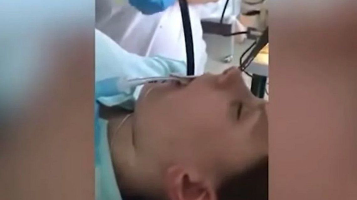 Rusia: fue al hospital porque no podía respirar y le sacaron una serpiente de la garganta