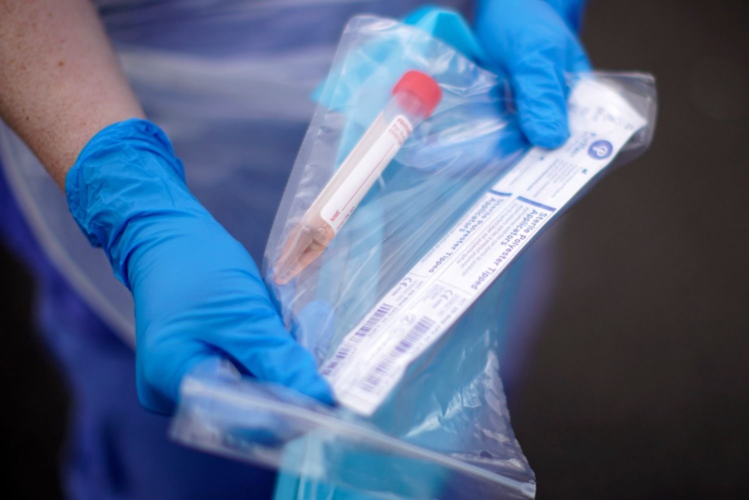 Coronavirus en Mendoza: Se recuperaron 384 pacientes, fallecieron 6 y se detectaron 613 nuevos casos