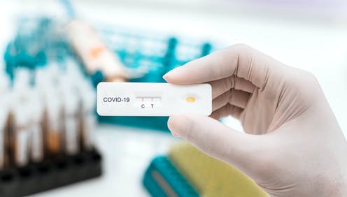 Esperan la llegada de  los test de antígenos que dan resultados de  Covid en 15 minutos