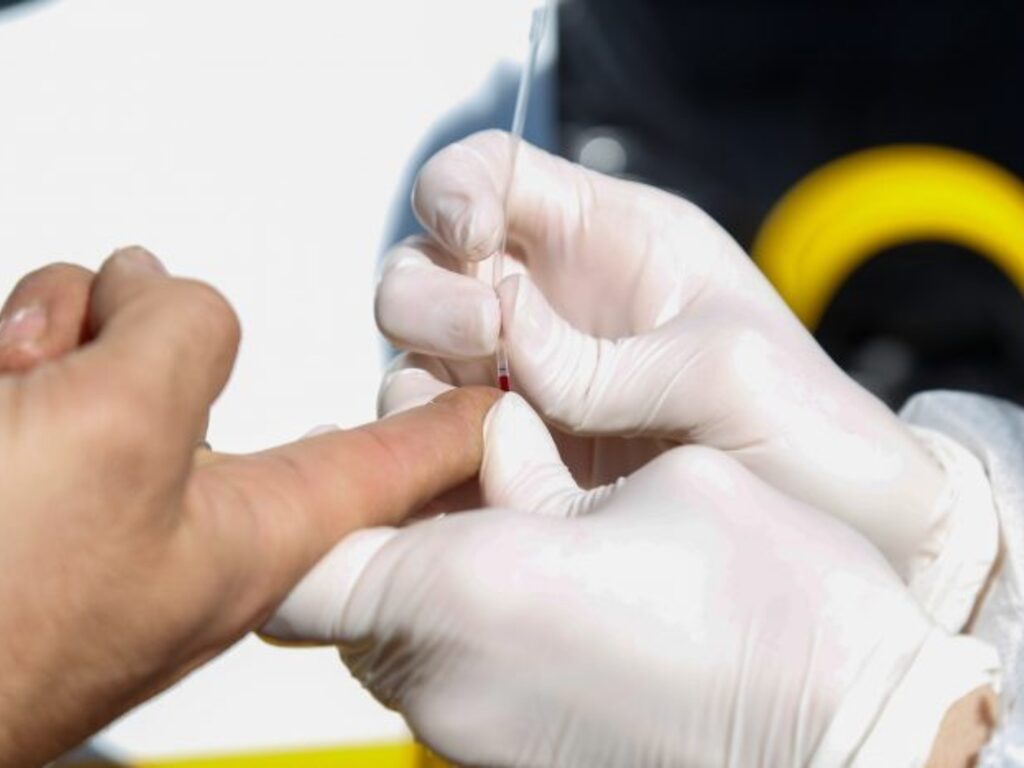 Cayeron 65% los testeos de VIH durante la cuarentena