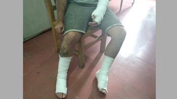 Buenos Aires: Capataz tiró a un albañil desde un segundo piso por hacer mal una losa