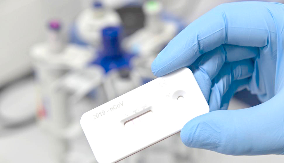 COVID- 19 en Mendoza: Se recuperaron 698 pacientes, fallecieron 4 y se detectaron 61 nuevos casos positivos