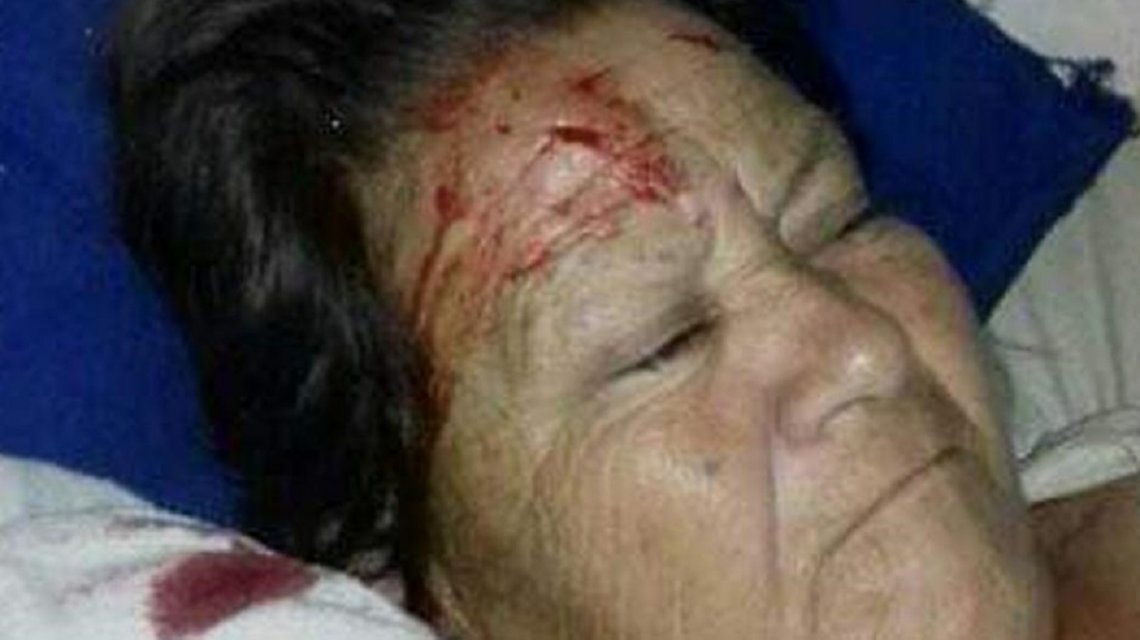 Santiago del Estero: a una mujer que estaba internada en un hospital le cayó un ventilador de techo en la cara