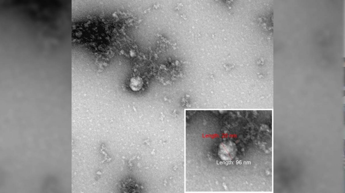 Preocupa la detección de la cepa sudafricana de coronavirus en 19 países europeos