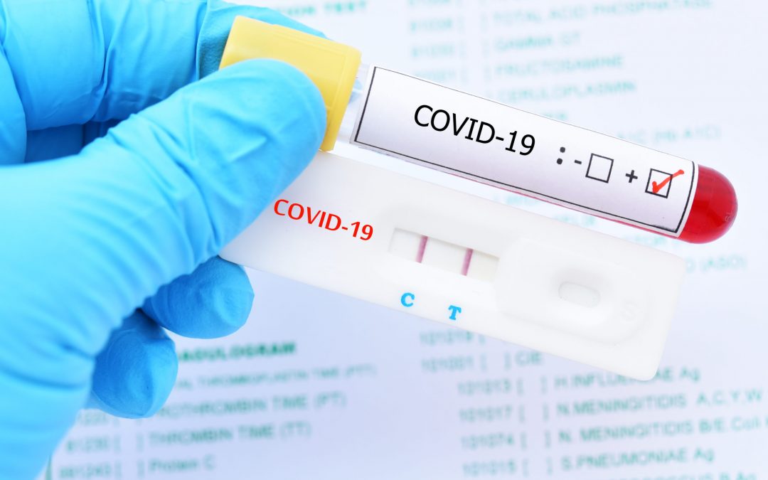 Este miércoles en San Rafael se detectaron 47 nuevos casos positivos de COVID- 19