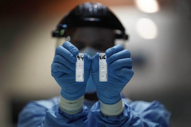COVID-19 en Córdoba: detectaron un caso de infección con la variante brasileña de Manaos