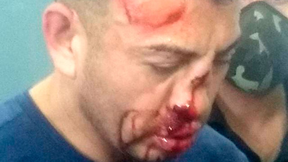 Desfiguraron a golpes al fisicoculturista acusado de estrangular a Analía Maldonado y quemar su cadáver