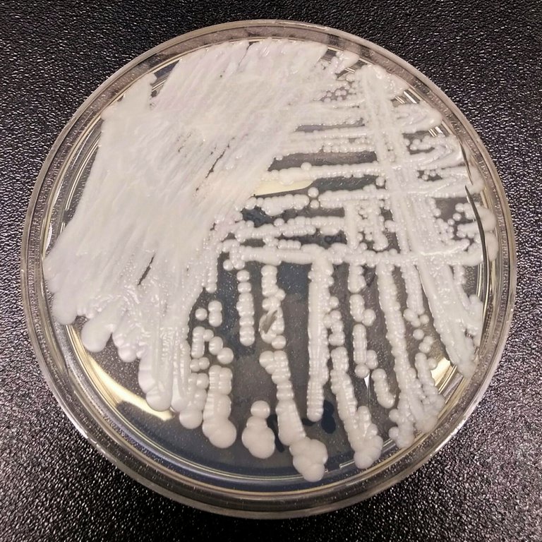 Alertan que se detectaron en Argentina nuevas superbacterias por el mal uso de antibióticos durante la pandemia