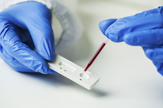 COVID- 19 en San Rafael: Se informaron 34 nuevos casos y una muerte