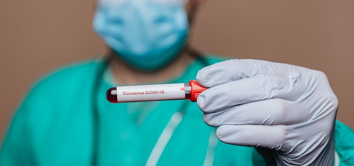 COVID- 19 en San Rafael: Se reportaron 67 nuevos casos y una muerte