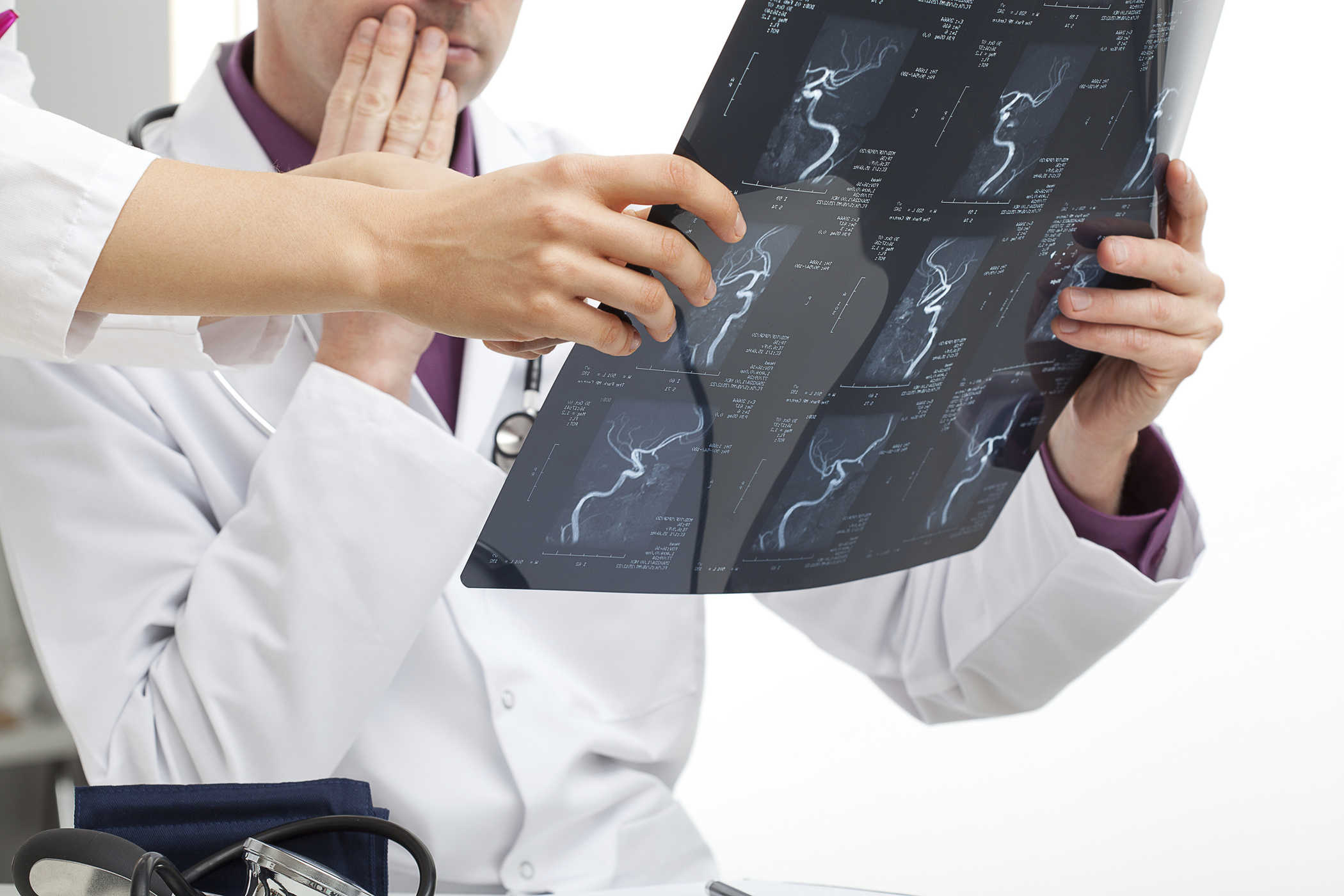 Cuáles son los efectos del coronavirus sobre  el sistema nervioso central