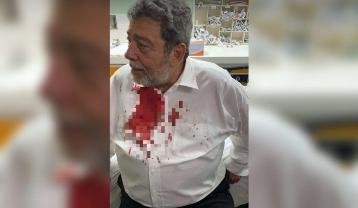 Apedrearon a un Primer Ministro en una marcha antivacunas