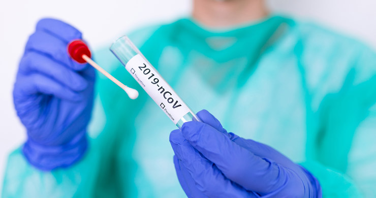 COVID- 19 en San Rafael: Se informaron 45 nuevos casos positivos y 3 fallecimientos