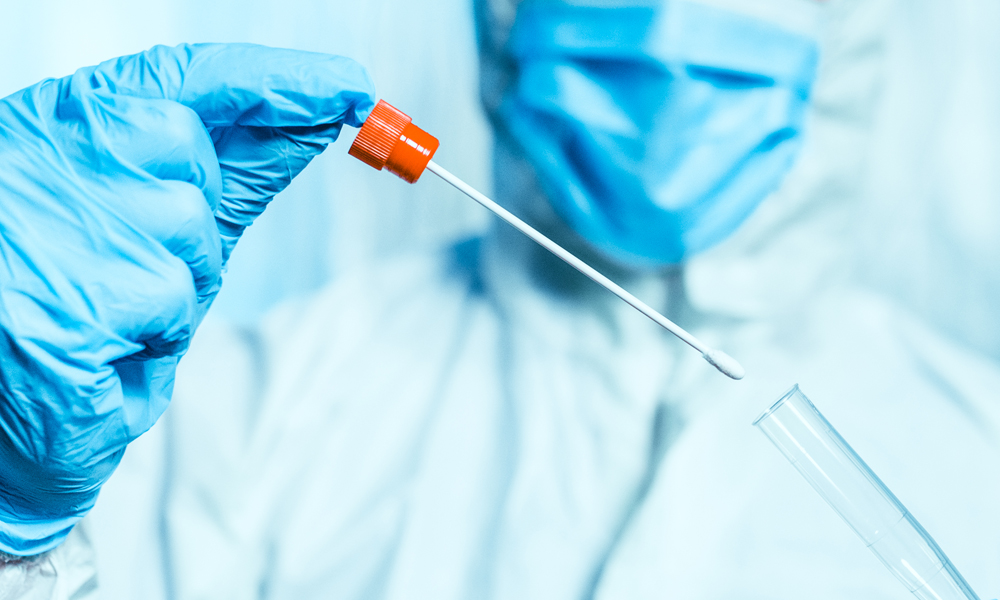 Este lunes en San Rafael se informaron 26 nuevos casos positivos de COVID- 19 y una muerte