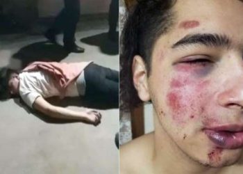 Brutal ataque de patovicas en Mendoza: un chico de 19 años denunció que lo agarraron entre cinco y no paraban de pegarle