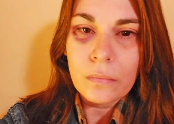 La vicedirectora agredida por una madre en Alvear tiene un edema en la cabeza