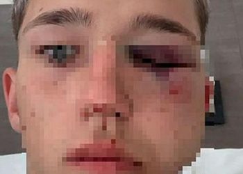 Cuatro rugbiers imputados en Salta por desfigurar a un adolescente en una fiesta