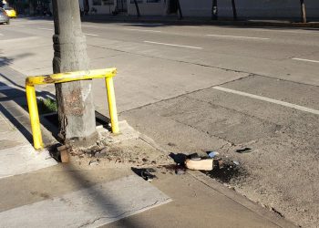 Una joven de 17 años fue acosada y atropellada en Córdoba: sufrió la amputación de una pierna