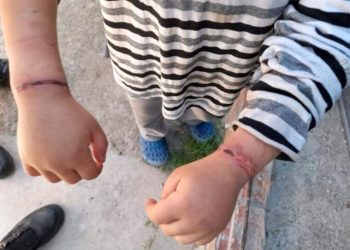 Habló el padre del nene torturado : “Le dije a la Justicia que esto iba a pasar, la madre me los sacó para hacerle esto”