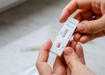 Autotest contra el coronavirus: más de la mitad de las farmacias del país se anotaron para venderlo