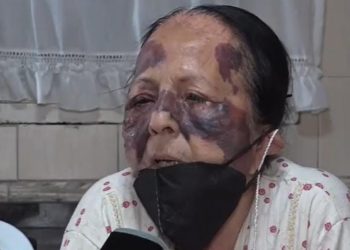 La violenta golpiza a una jubilada para robarle: «Me arrastraban de los pelos»