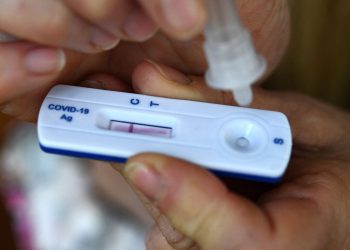 Cuándo llegarán los autotest de coronavirus a las farmacias mendocinas y cómo se podrán adquirir