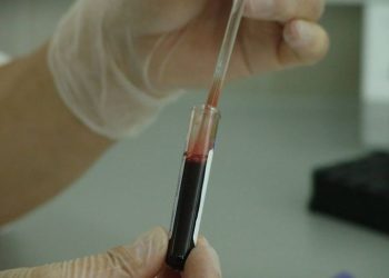 Alerta: Descubren variante del VIH más virulenta y contagiosa