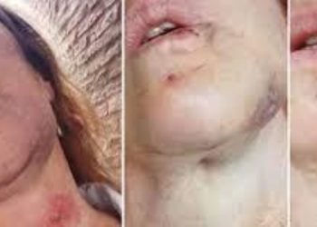 Alarma en pleno Buenos Aires por un hombre que agrede a mujeres en la calle: las golpea y se da a la fuga