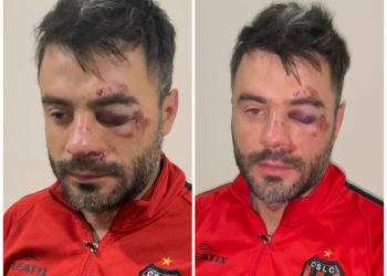 Brutal golpiza a un joven a la salida de un recital en Tunuyán