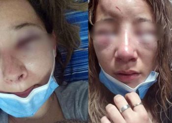 Atacaron ferozmente a una joven a la salida de un boliche: la desfiguraron y le arrancaron las uñas