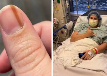 Creyó que tenía un lunar en la uña, fue al médico después de 10 años y el diagnóstico lo devastó: “Mi corazón se desplomó”