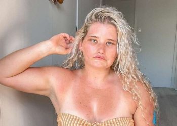 De sufrir bullying a ser modelo: el caso de la joven que no puede sonreír