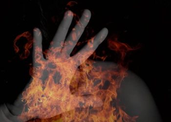 Se quemó el 50 % del cuerpo y murió: investigan a la pareja