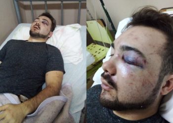 Un joven fue desfigurado luego de una brutal golpiza en un boliche de Alvear