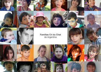 Explican qué es el Síndrome de Cri du Chat y cómo afectaa las personas