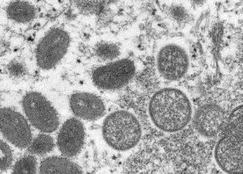 El mundo en alerta: Suecia detectó el primer caso de viruela del mono en el país