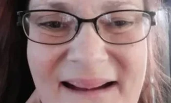 Tiene 36 años y vive un calvario por un diente infectado: le extrajeron la mandíbula y ya no sale de su casa