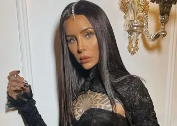 Cande Tinelli mostró el nuevo retoque estético que se hizo en su cara