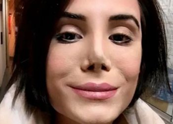 Revelaron cómo está Felipe Pettinato tras el incendio que terminó con la vida de su mejor amigo Melchor Rodrigo