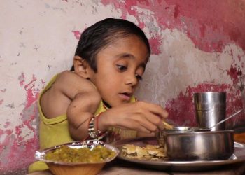 La impactante historia del niño «hecho de vidrio»: tiene rotos 100 huesos por una rara enfermedad