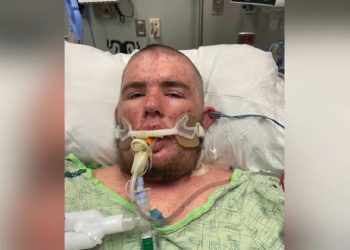 Cortaba ramas de un árbol, se llevó puesto un panal y lo atacaron 20 mil abejas: “Estuvo una semana en coma”