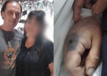 Un hombre murió por la picadura de una araña de rincón y su familia denunció mala praxis en un hospital de la provincia de Buenos Aires