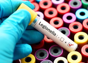 Muere un hombre de 64 años por neumonía bilateral en Tucumán y suman cinco los casos fatales