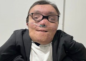 Murió Lucas “Capocha” Alaniz, el joven bahiense con los huesos de cristal que enfrentó la vida como un juego